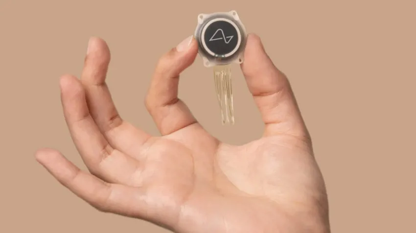 Implantaron el primer chip cerebral diseñado para ayudar a personas cuadripléjicas