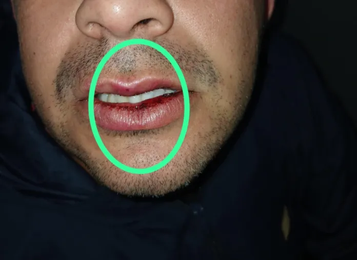 Una pareja golpeó a un policía porque se negaban a identificarse: llevaban cocaína