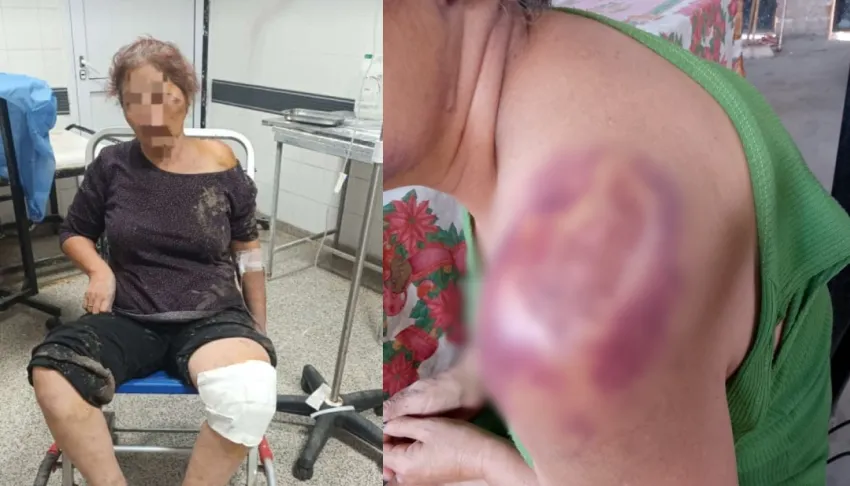 Dos motochorros empujaron violentamente a una enfermera de 53 años que circulaba en moto para robarle