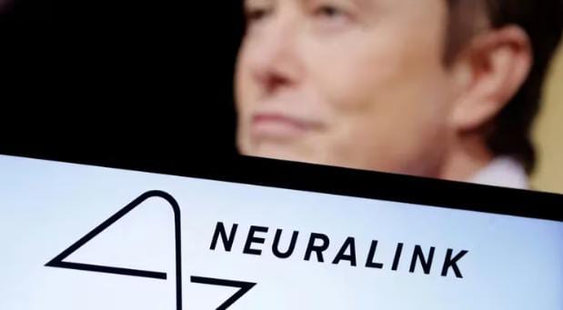 Neuralink: a una semana del primer implante hay hermetismo sobre la salud del paciente con el chip cerebral