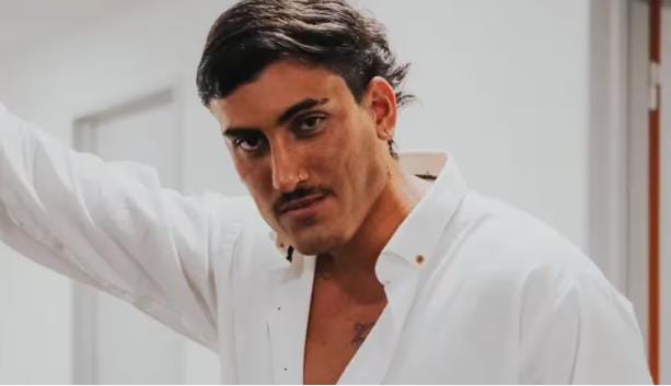 Tomás Holder se hizo un retoque estético en la cara y en las redes lo compararon con Ricardo Fort