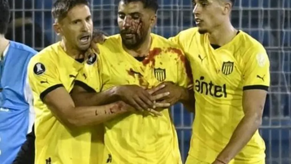 Escándalo: Un jugador de Peñarol recibió un corte tras ser agredido por un hincha de Rosario Central