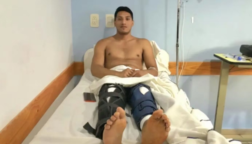 La Plata: un joven fue a hacerse una cirugía en la rodilla y por error le operaron las dos piernas