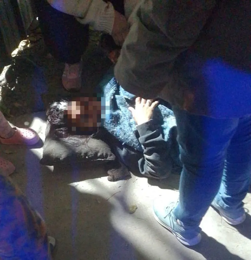 Brutal agresión en Resistencia: atacaron a golpes a una mujer con una manopla metálica