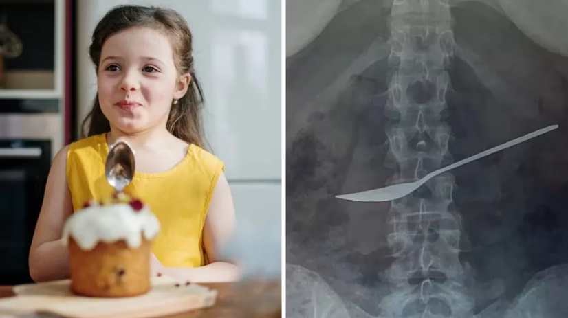 Una nena se quejó del dolor de panza y la operaron de urgencia: lo que tenía en el estómago impactó a todos