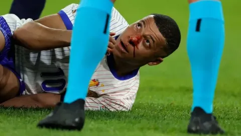 Alerta en Francia: Mbappé terminó ensangrentado y temen una fractura