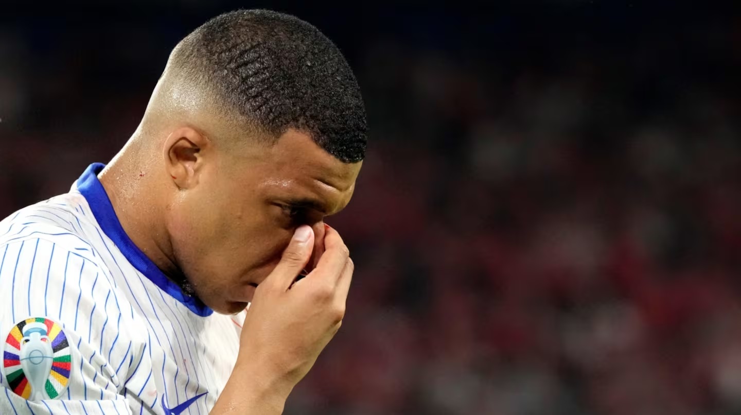 Así le quedó la cara a Kylian Mbappé tras la fractura de nariz que sufrió en la Eurocopa