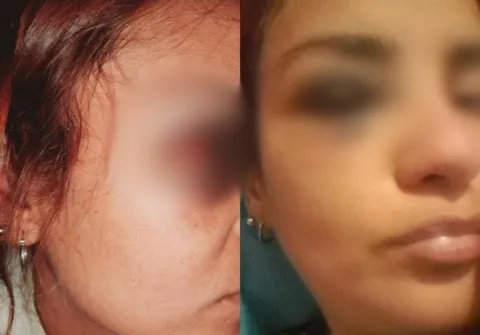 Fue a la casa de su novio y se encontró con dos mujeres que la agredieron brutalmente