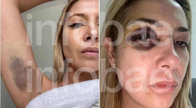 La denuncia de Fabiola Yañez contra Alberto Fernández: “Venís golpeándome hace tres días seguidos”