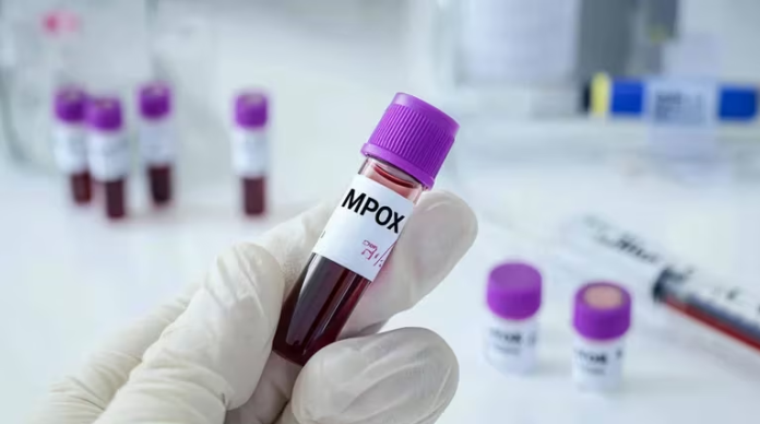 Alerta global por la viruela del mono: seis preguntas clave respondidas por la OMS