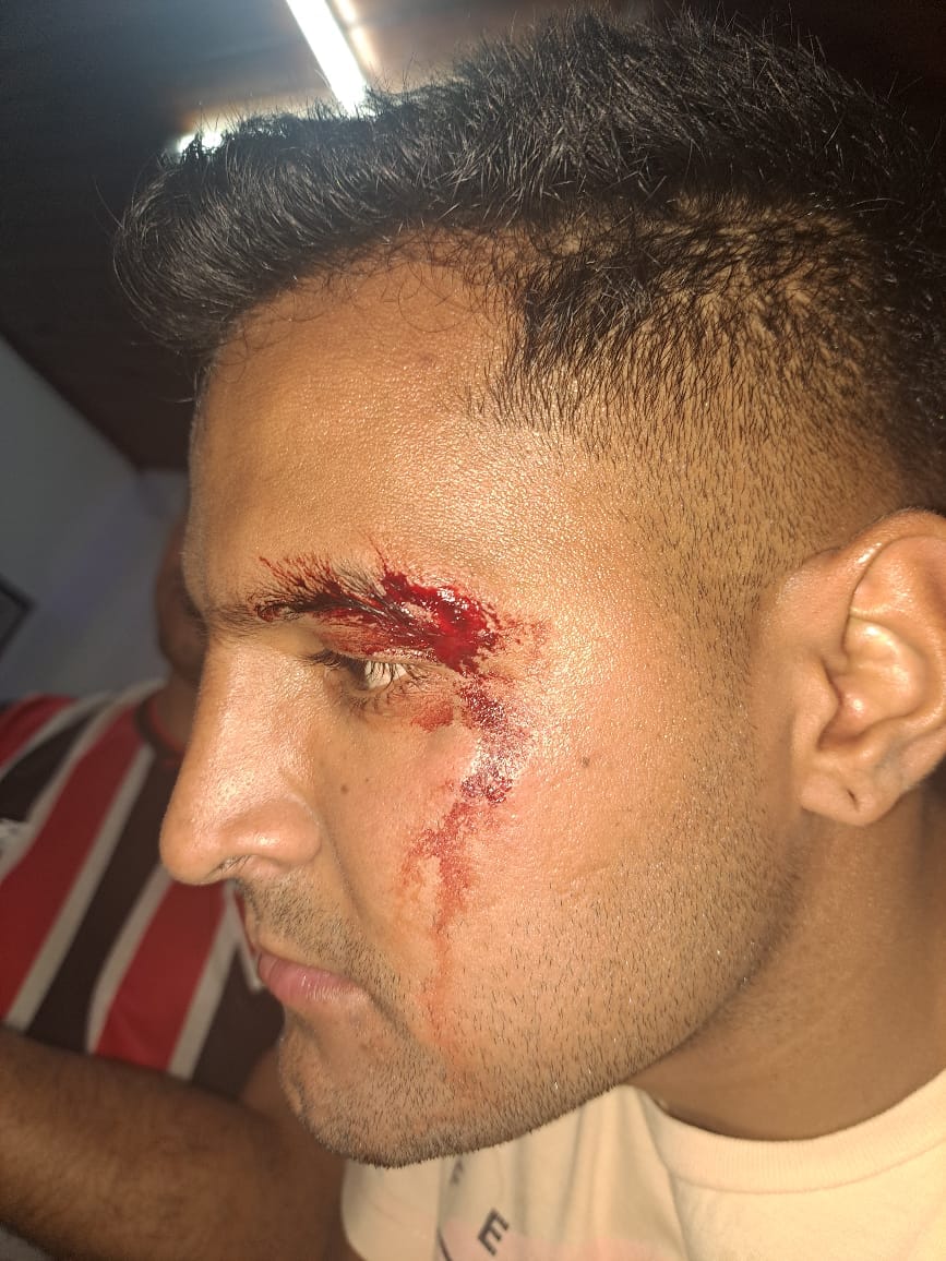 Tres empleados policiales lesionados al intentar detener a un ciudadano por robo