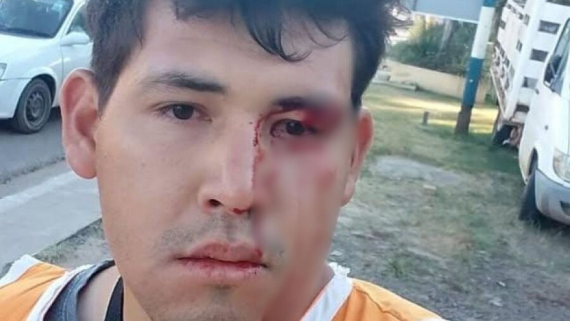 Corrientes: Vendedores ambulantes golpearon a un joven con retraso madurativo