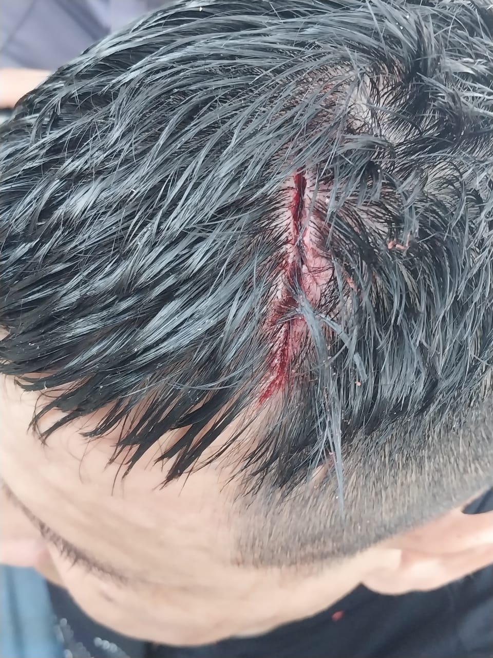 Operativo policial controló incidentes en cancha de Villa Alvear