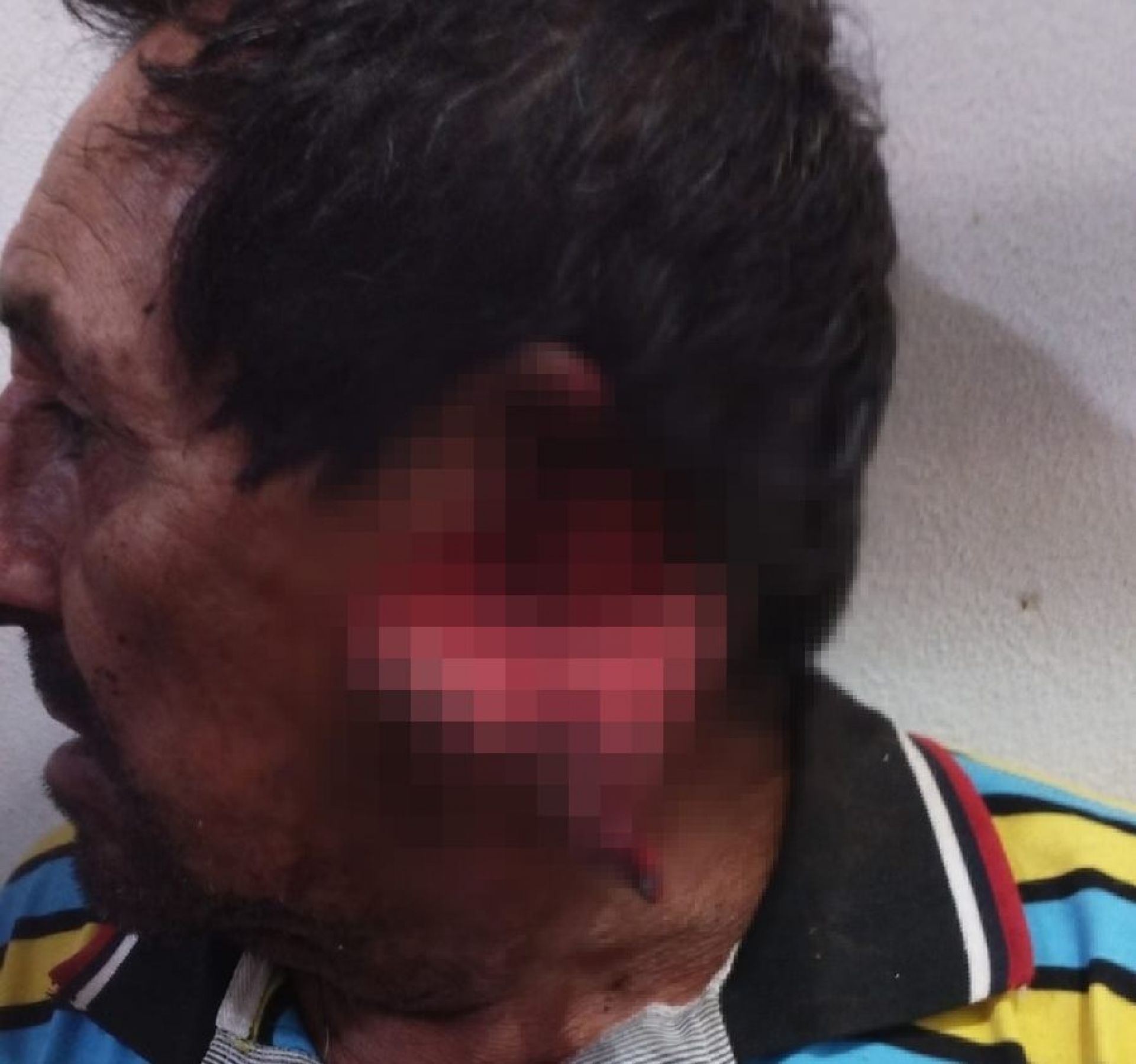 Una discusión entre amigos terminó con un hombre desfigurado por arma blanca