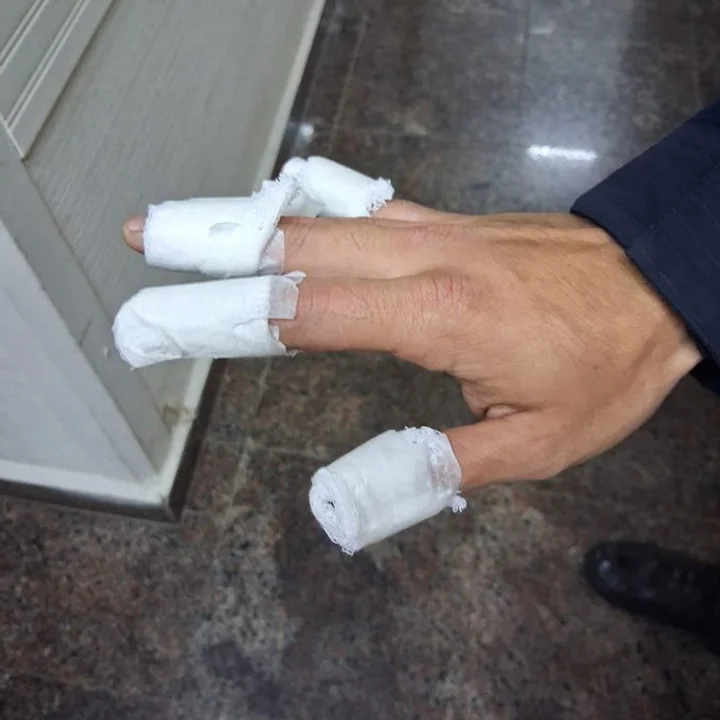 Tres adolescentes quemaron a un policía con una bomba molotov y fueron detenidos en Córdoba